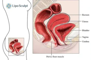 Treatment For A Leaky Bladder 2 How EM Chair treatment Ibstock can help Leaky bladder issues. Read more now!