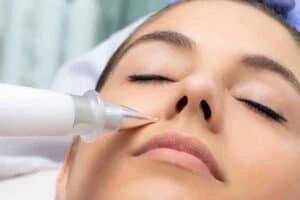 Best Actinic Keratoses Removal 3 Actinic keratoses Ibstock solutions - book in today!